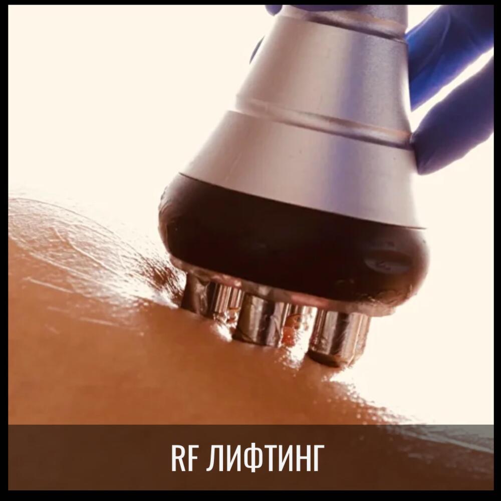 RF-лифтинг