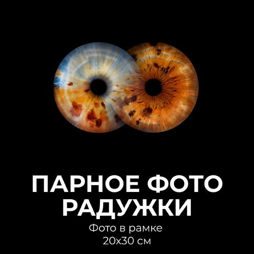 Парное фото радужки + Фото в рамке 20х30
