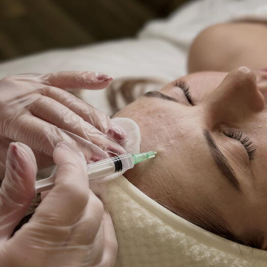 Биоревитализация