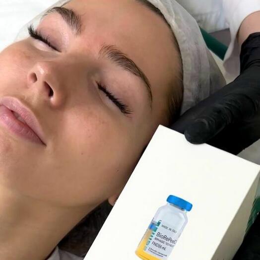 Абонемент на курс пилинга (5 процедур)